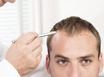 cropped-HairLossBalding-1.jpg