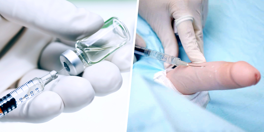 Penis Filler for Penis Enlargement Penis Filler for Penis Enlargement