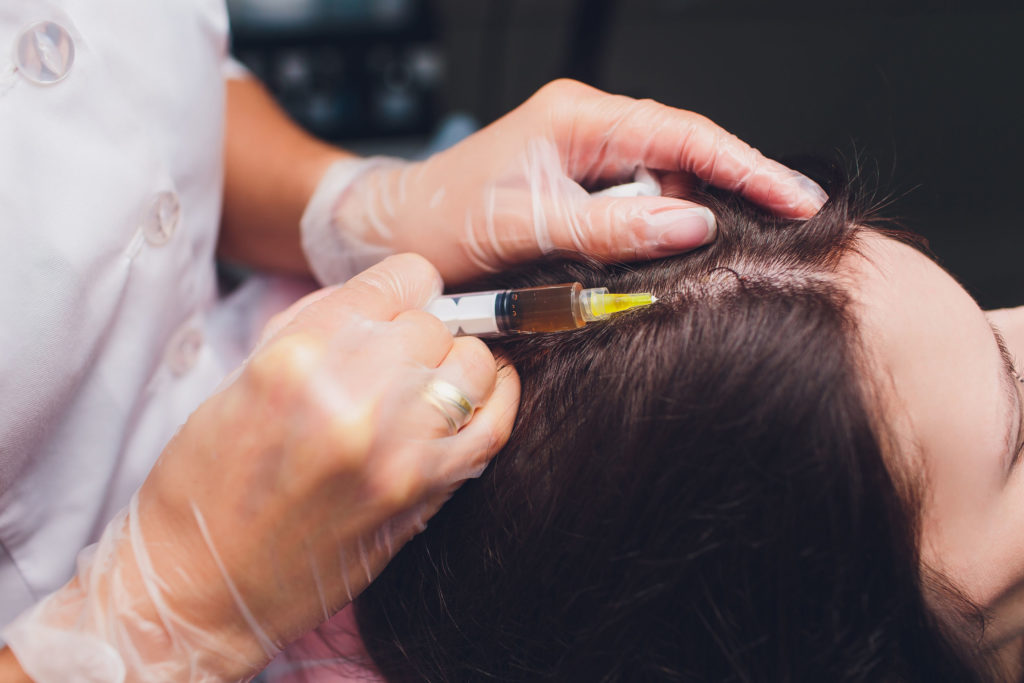 Platelet rich plasma injection procedure. Hair growth stimulation. PRP therapy process. Platelet-Rich Plasma (PRP) Revitalises Hair Follicles