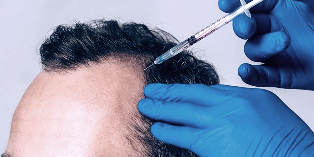 Hair Filler