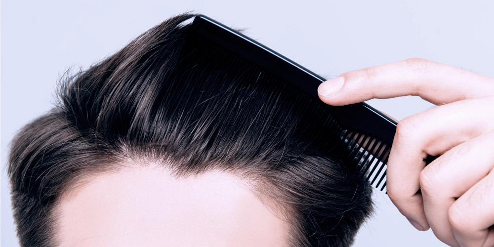 Hair Mesotherapy 05 Benefits of hair mesotherapy
