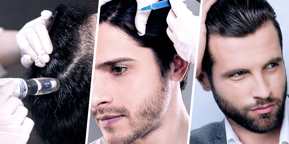 Hair Mesotherapy 06 Hair Mesotherapy