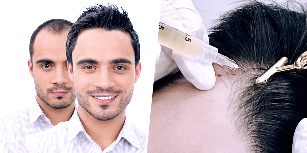 Hair StemCells