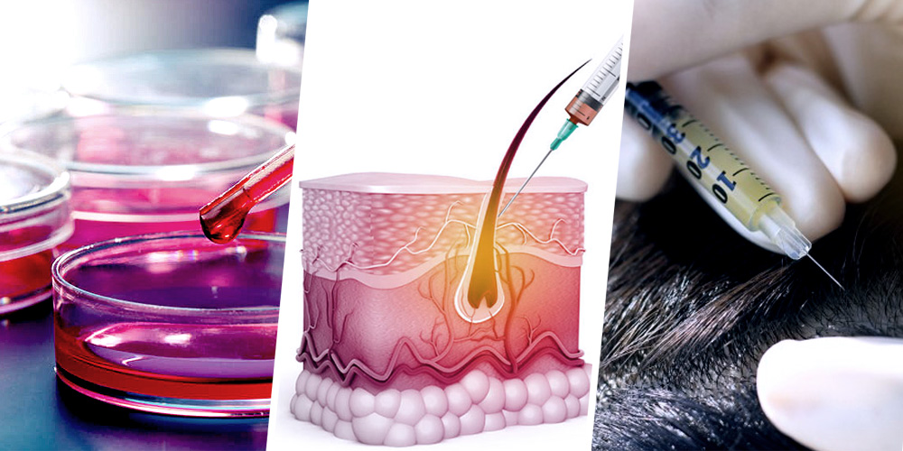 Hair StemCells