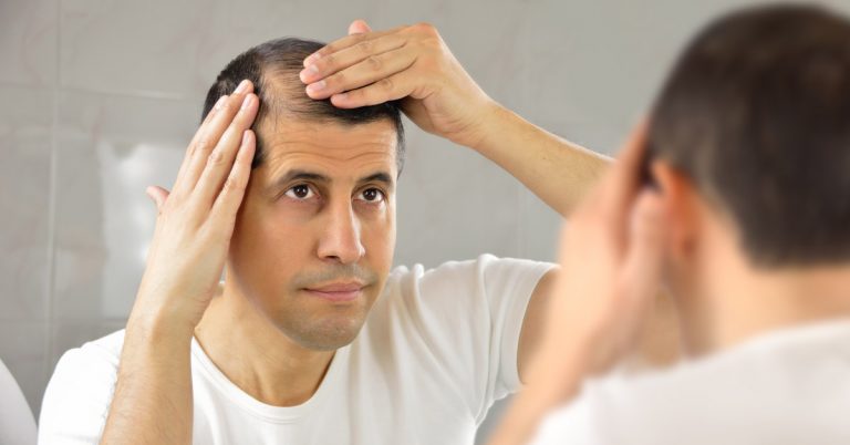 Do Women Prefer Bald Men? Do Women Prefer Bald Men?