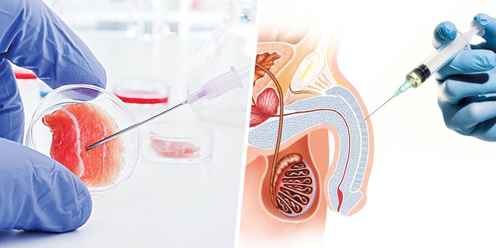 HOW DOES STEM CELL TREATMENT WORK