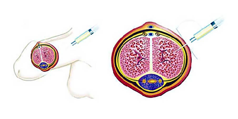 HOW DOES STEM CELL TREATMENT WORK